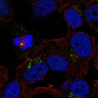 Anti-TRPM1 Antibody