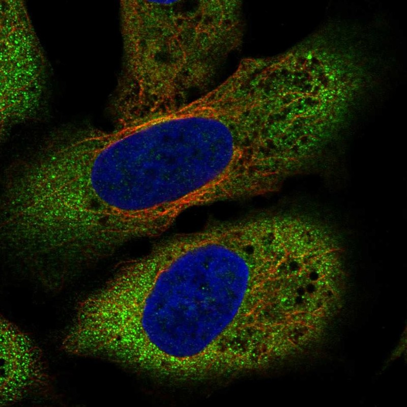 Anti-FZD8 Antibody