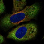 Anti-FZD8 Antibody