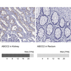 Anti-ABCC2 Antibody