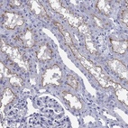 Anti-ABCC2 Antibody