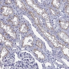 Immunohistochemical staining of human kidney shows high expression.