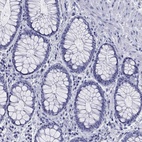 Immunohistochemical staining of human rectum shows low expression as expected.