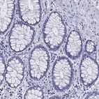 Anti-ABCC2 Antibody