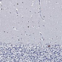 Anti-SKOR1 Antibody