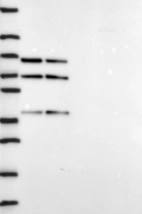 Anti-DDX5 Antibody