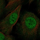 Immunofluorescent staining of human cell line U-2 OS shows localization to nucleoplasm & cytosol.