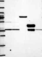 Anti-TSPAN15 Antibody