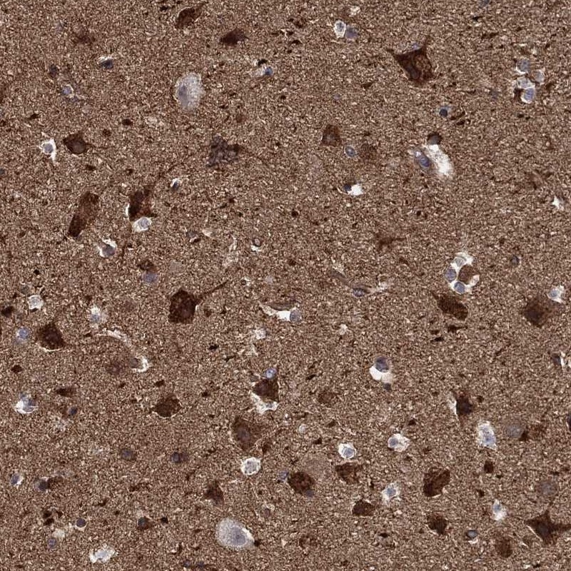 Anti-PPFIBP1 Antibody