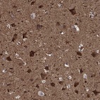 Anti-PPFIBP1 Antibody