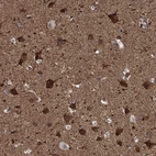 Anti-PPFIBP1 Antibody