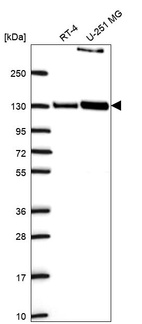 Western blot analysis in human cell line RT-4 and human cell line U-251 MG.