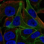 Immunofluorescent staining of human cell line SK-MEL-30 shows localization to plasma membrane.