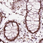 Immunohistochemical staining of human colon using Anti-ELF2 antibody HPA071166.