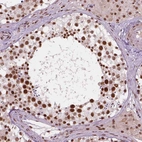 Immunohistochemical staining of human testis shows strong nuclear positivity in cells in seminiferous ducts.