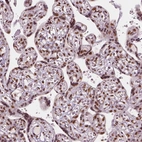 Immunohistochemical staining of human placenta shows strong nuclear positivity in trophoblastic cells.