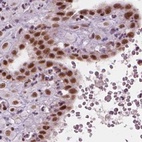 Immunohistochemical staining of human placenta using Anti-ELF2 antibody HPA071166.