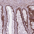 Immunohistochemical staining of human rectum shows strong nuclear positivity in glandular cells.