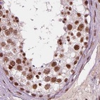 Immunohistochemical staining of human testis using Anti-ELF2 antibody HPA071166.