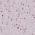 Immunohistochemical staining of human cerebral cortex shows strong nuclear positivity in neurons.