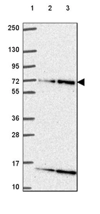 Lane 1: Marker [kDa] 250, 130, 95, 72, 55, 36, 28, 17, 10_br/_Lane 2: Human cell line RT-4_br/_Lane 3: Human cell line U-251 MG