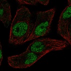 Immunofluorescent staining of human cell line RT4 shows localization to nucleoplasm.