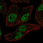 Immunofluorescent staining of human cell line RT4 shows localization to nucleoplasm.