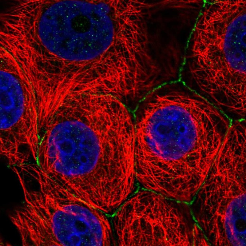 Anti-SLC2A11 Antibody