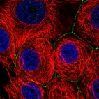 Anti-SLC2A11 Antibody
