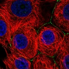 Anti-SLC2A11 Antibody