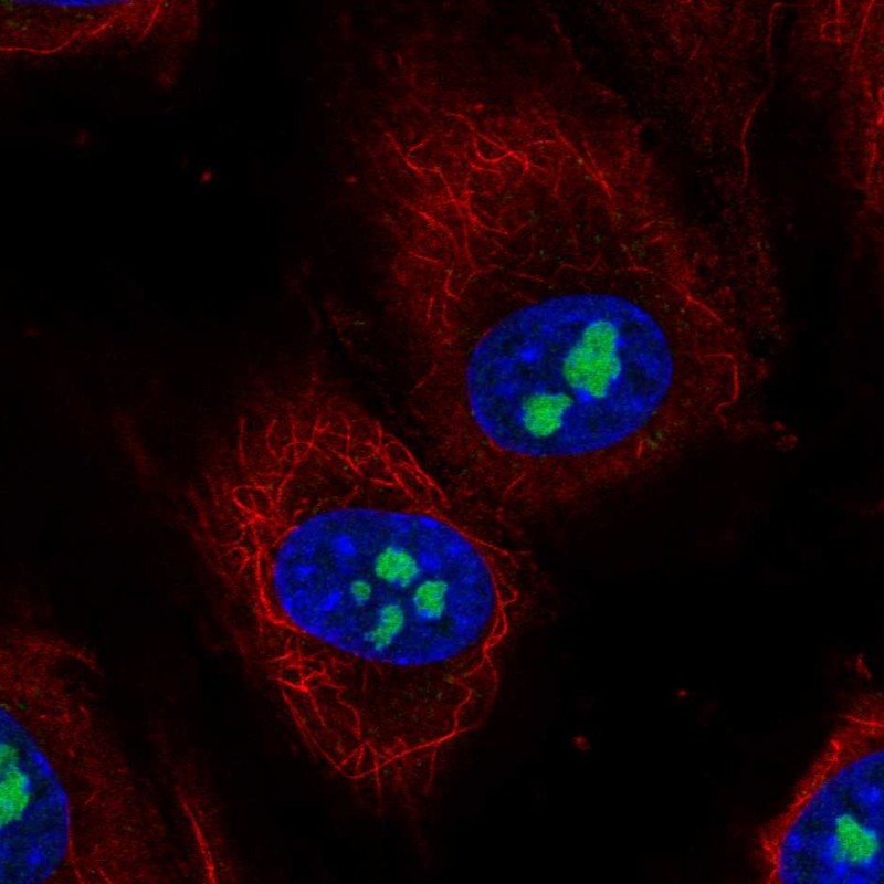 Anti-TMEM217 Antibody