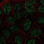 Anti-RTP4 Antibody