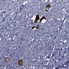 Anti-ZP3 Antibody