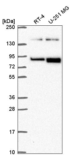 Anti-EPHB2 Antibody