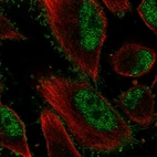Immunofluorescent staining of human cell line U-251 MG shows localization to nucleoplasm & plasma membrane.