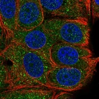 Anti-TAB2 Antibody