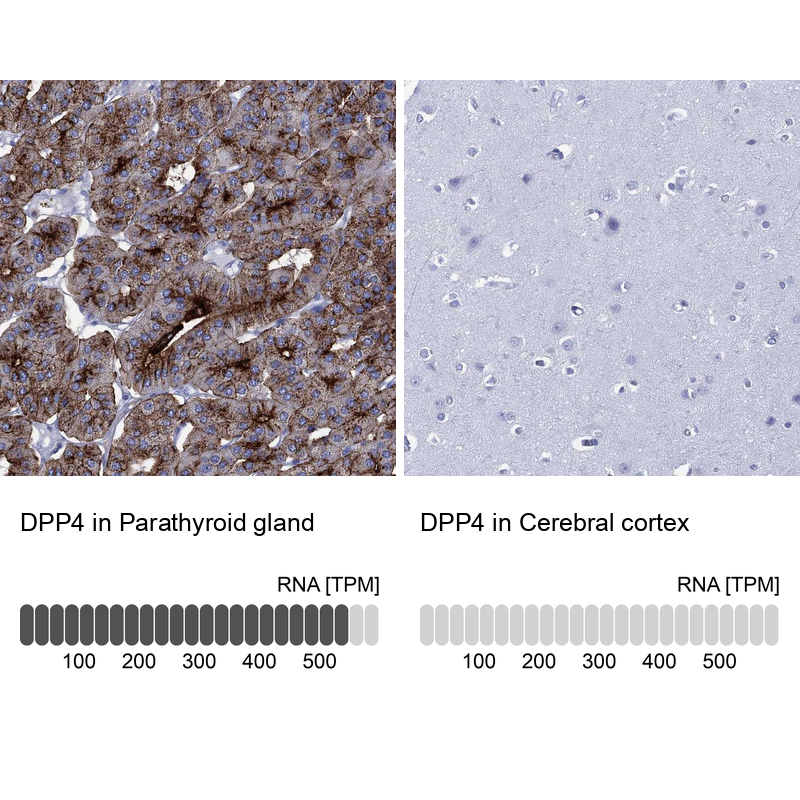 Anti-DPP4 Antibody