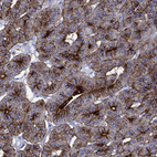 Immunohistochemical staining of human parathyroid gland shows strong membranous positivity in glandular cells.