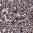 Immunohistochemical staining of human parathyroid gland shows strong membranous positivity in glandular cells.