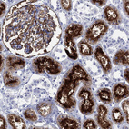 Immunohistochemical staining of human kidney shows strong membranous positivity in cells in proximal tubules.