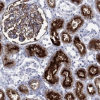 Immunohistochemical staining of human kidney shows strong membranous positivity in cells in proximal tubules.