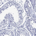 Immunohistochemical staining of human testis shows no positivity in cells in seminiferous ducts as expected.