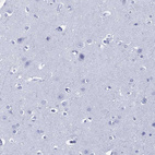 Immunohistochemical staining of human cerebral cortex shows no positivity in neuronal cells as expected.