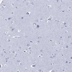 Immunohistochemical staining of human cerebral cortex shows no positivity in neuronal cells as expected.