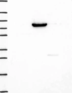 Lane 1: Marker [kDa] 250, 130, 95, 72, 55, 36, 28, 17, 10 | Lane 2: RT4 | Lane 3: U-251 MG | Lane 4: Human Plasma | Lane 5: Liver | Lane 6: Tonsil