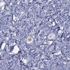 Anti-FIGLA Antibody