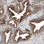 Anti-LZTR1 Antibody