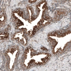 Immunohistochemical staining of human prostate shows strong granular cytoplasmic positivity in glandular cells.