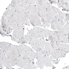 Immunohistochemical staining of human skeletal muscle shows no positivity in myocytes as expected.