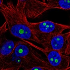 Immunofluorescent staining of human cell line SK-MEL-30 shows localization to nucleoli.